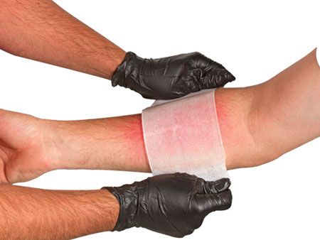 NAR BurnTec Brannbandasje - North American Rescue